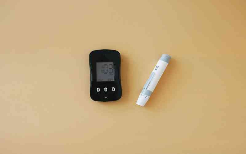 外觀檢測技術(shù)如何支持精密工業(yè)制造 外觀檢測技術(shù)如何支持精密工業(yè)制造